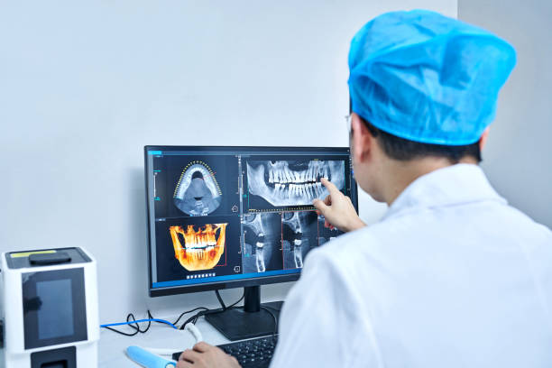 Best Emergency Tooth Extraction in Port Byron, NY